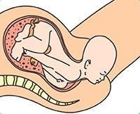 https://promaternity.com/uploads/RESEG1673SIMULACION.jpg