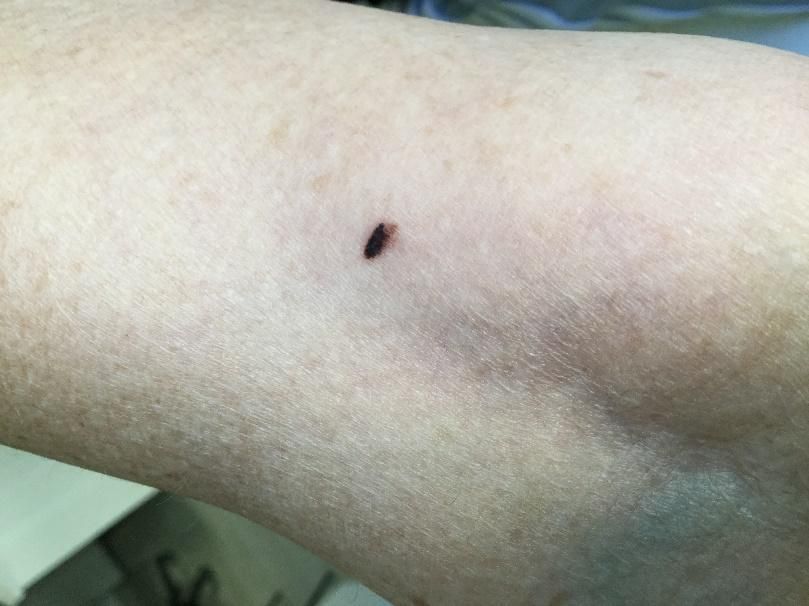 Tatuaje en el brazo de una persona Descripción generada automáticamente con confianza baja
