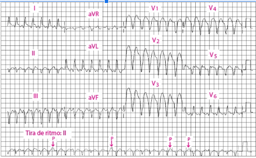 A graph of a heart rate
Description automatically generated with medium confidence