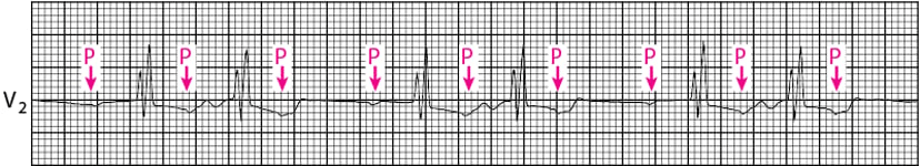 A graph with a graph and arrows
Description automatically generated with medium confidence