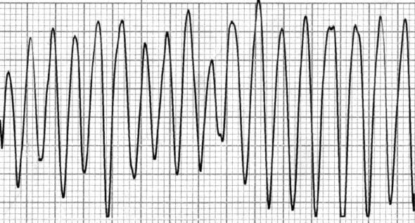 A graph with a graph on it
Description automatically generated
