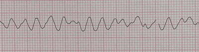 A graph with a graph on it
Description automatically generated