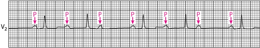 A graph with a line graph and a red arrow pointing to the side
Description automatically generated with medium confidence
