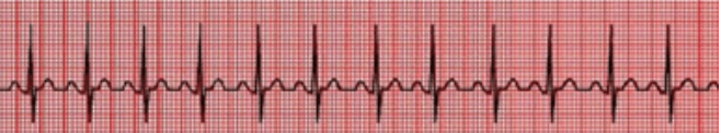 A graph with a line of a heart beat
Description automatically generated with medium confidence
