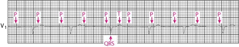A graph with arrows pointing to the top
Description automatically generated