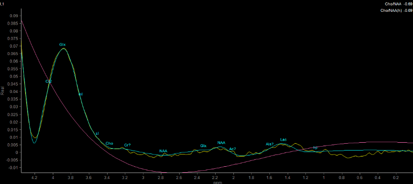 Gráfico
Descripción generada automáticamente