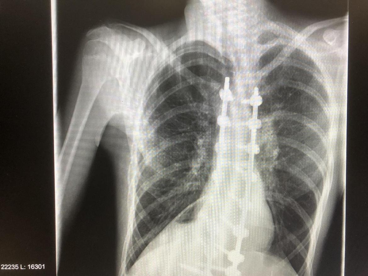 Imagen que contiene corbata, radiografía, hombre, vistiendo
Descripción generada automáticamente