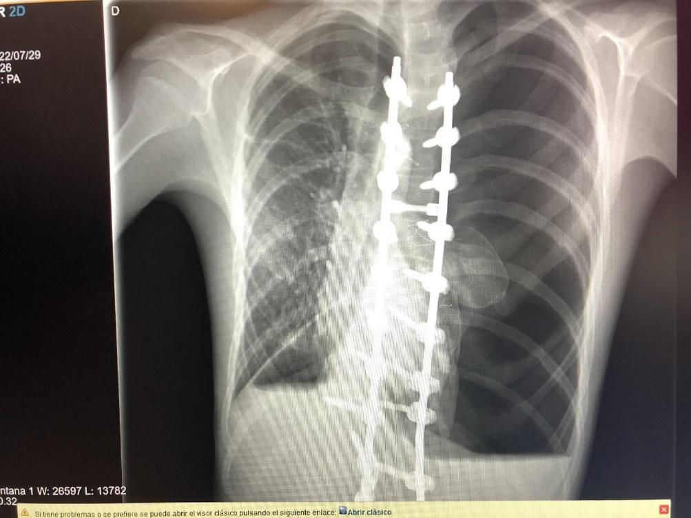 Imagen que contiene radiografía, monitor, hombre, tabla
Descripción generada automáticamente
