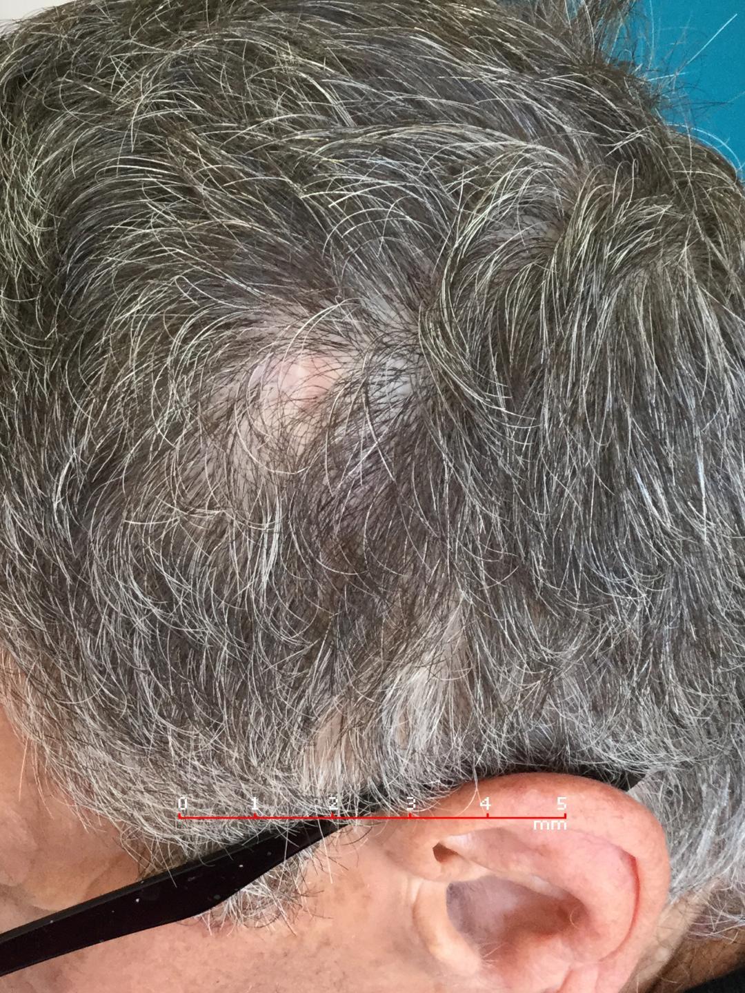 Cara de una persona con el cabello largo El contenido generado por IA puede ser incorrecto.
