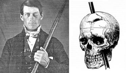 phineas-gage-accidente-cerebro-cvdnoticias.png