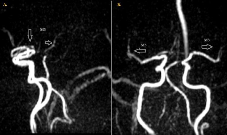 C:\Users\tatis\OneDrive\Documentos\figura 1 vasculitis...jpg