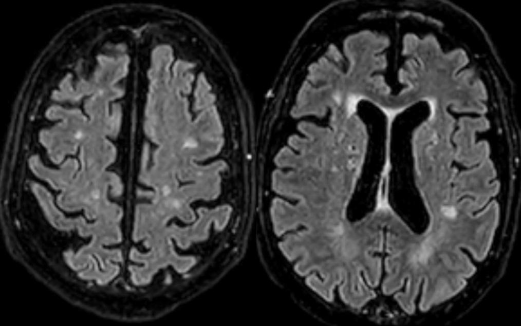 C:\Users\tatis\OneDrive\Documentos\figura 2 vasculitis.jpg