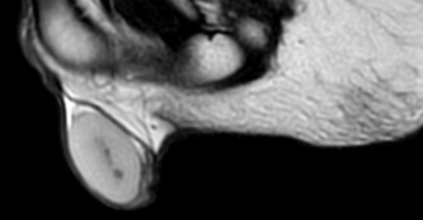 Imagen en blanco y negro de una persona
El contenido generado por IA puede ser incorrecto.