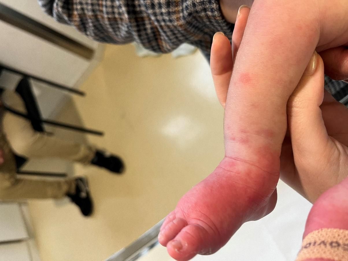 Una mano muestra un objeto en la mano
El contenido generado por IA puede ser incorrecto.