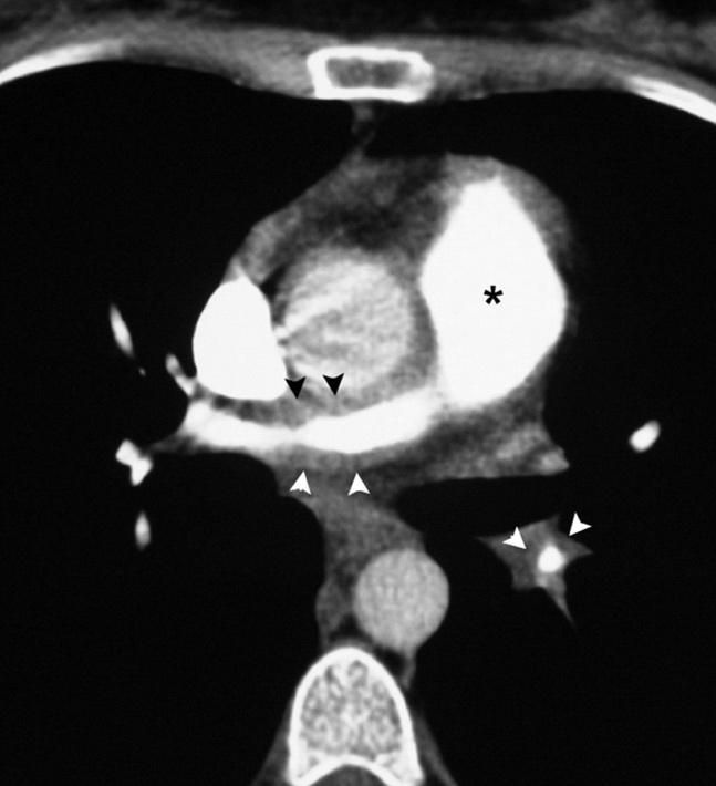 https://ajronline.org/cms/10.2214/ajr.184.3.01840720/asset/images/00_04_0411_01.jpeg