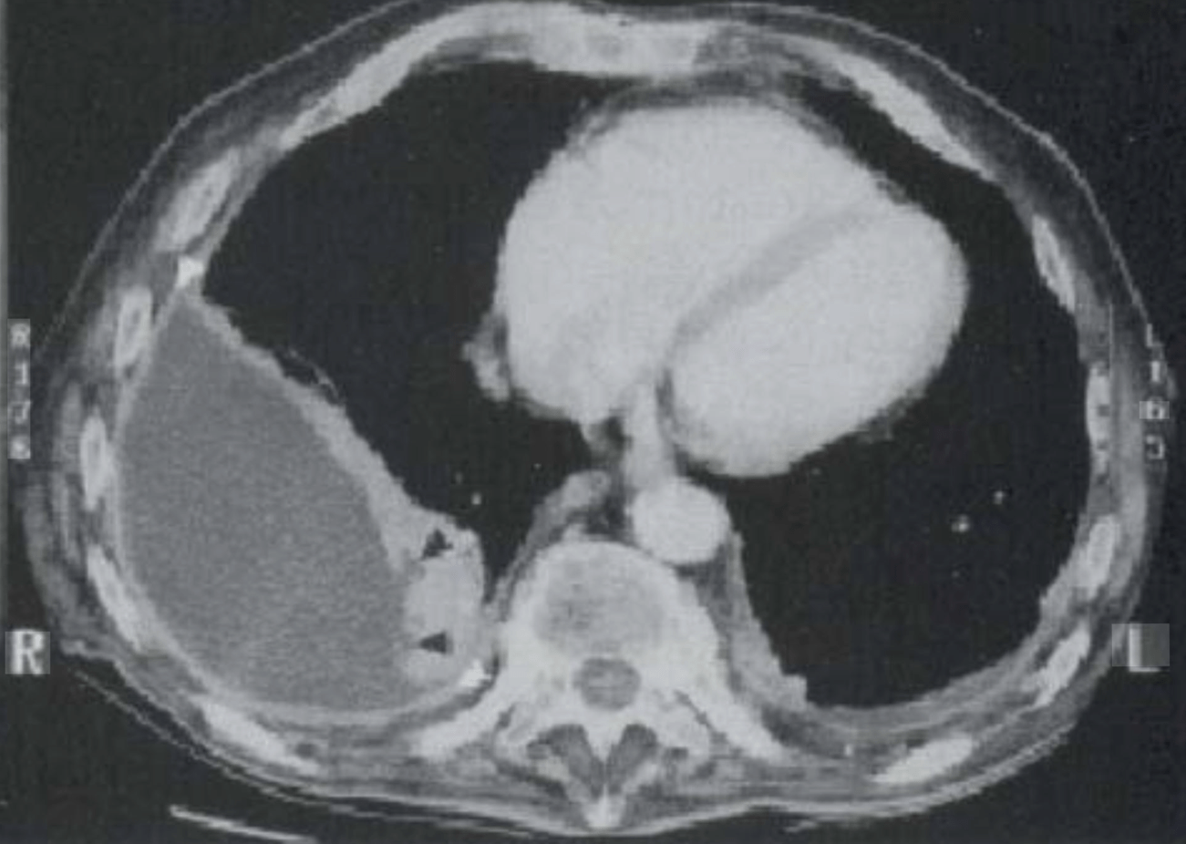 Imagen en blanco y negro El contenido generado por IA puede ser incorrecto.