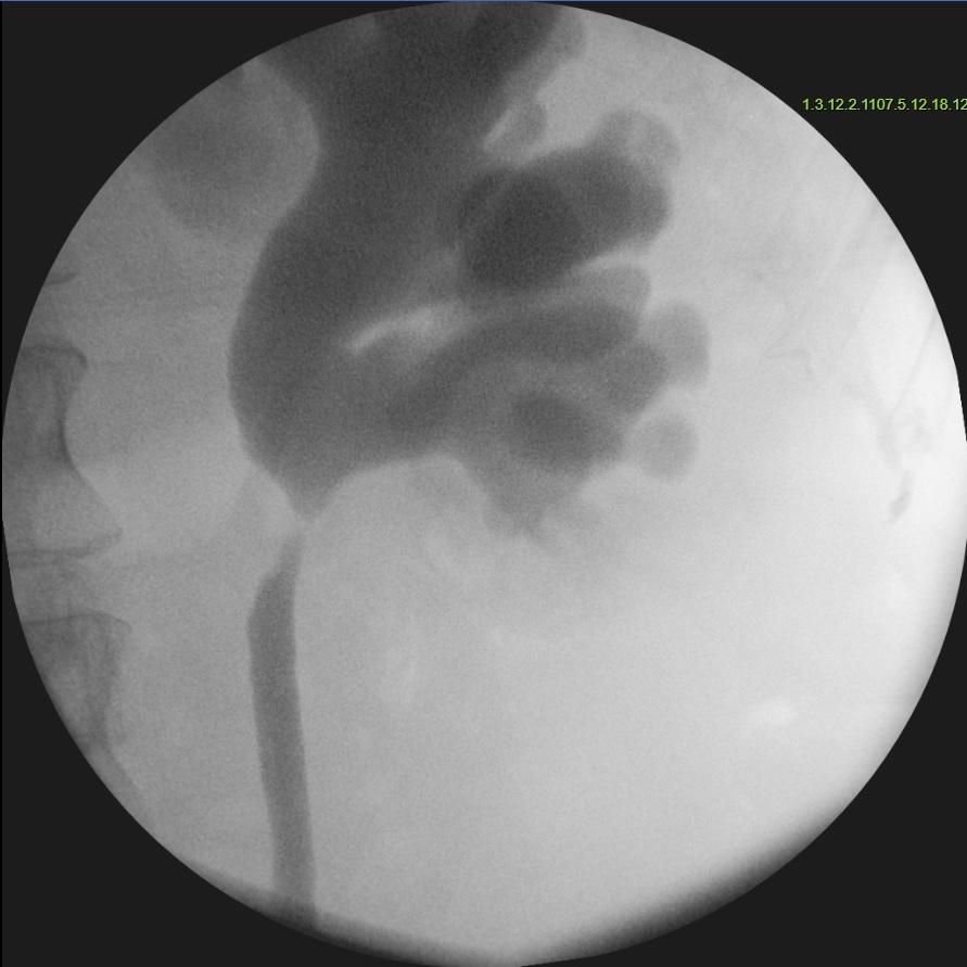 C:\Users\uromed\Downloads\pielografia.jpg