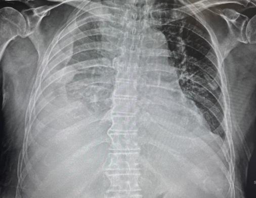 Imagen que contiene radiografía, parado, hombre Descripción generada automáticamente