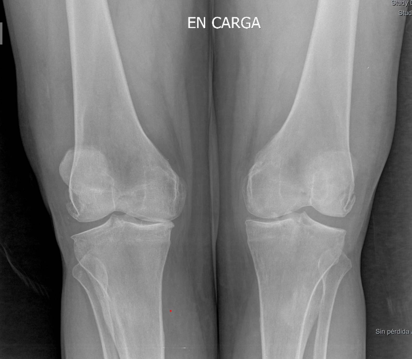 Imagen que contiene ropa, interior, radiografía, tatuaje
El contenido generado por IA puede ser incorrecto.
