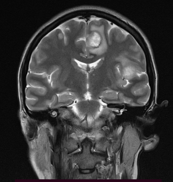 QUEZADA COFRE CARLA ALEJANDRA (35y) - 29/11/2024 7:34:25 - t2_fse_cor - RadiAnt DICOM Viewer 2025.2 (64-bit) - trial version - 14 days left - purchase a license at https://radiantviewer.com/store/