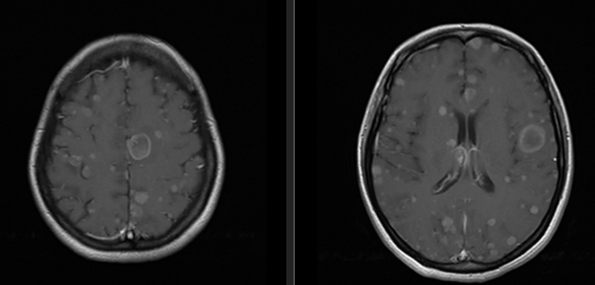 QUEZADA COFRE CARLA ALEJANDRA (35y) - 29/11/2024 8:25:24 - GD_t1_fse_tra - RadiAnt DICOM Viewer 2025.2 (64-bit) - trial version - 14 days left - purchase a license at https://radiantviewer.com/store/