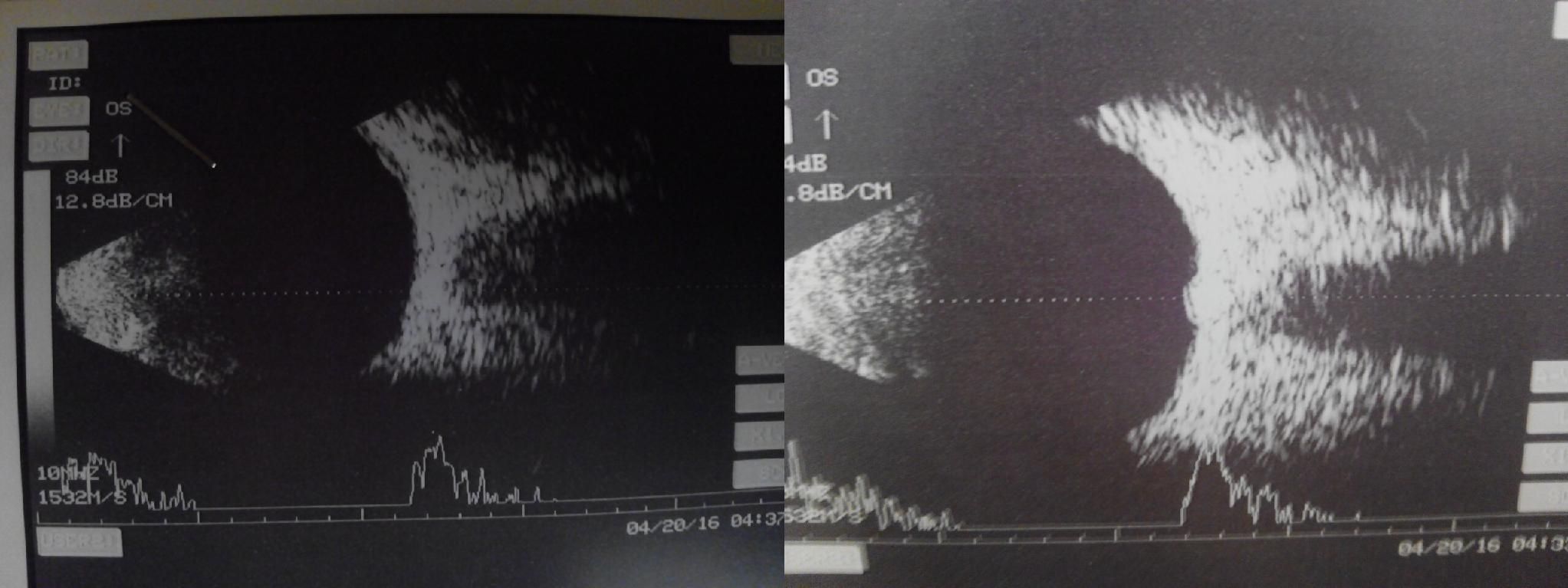 Picture 2